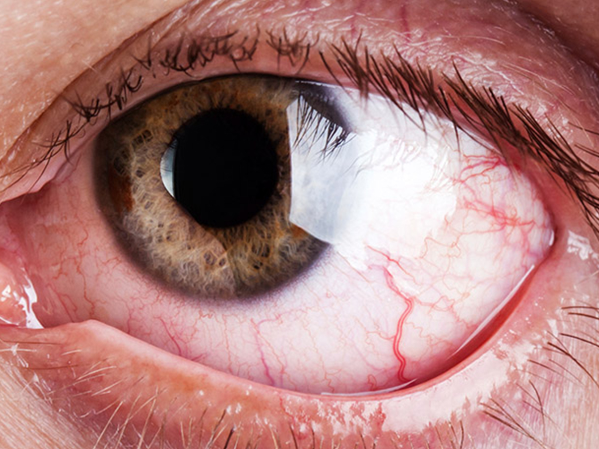 Romatolojik Hastalıklar