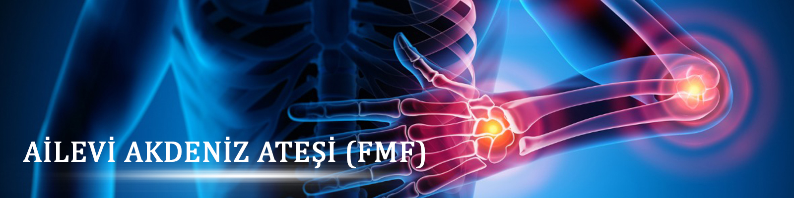 Ailevi Akdeniz Ateşi (FMF)